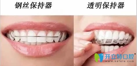 解答:上牙包住下牙多少正常?