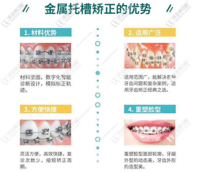 面诊三次后终于拿到天津红桥区雅馨口腔矫正牙齿收费价格