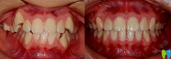 深圳爱康健口腔怎么样？看爱康健牙齿正畸