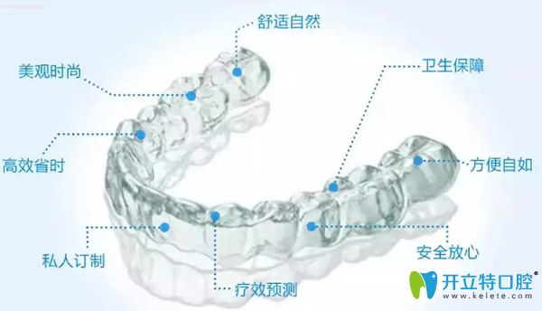 极速版隐适美iGO的优势