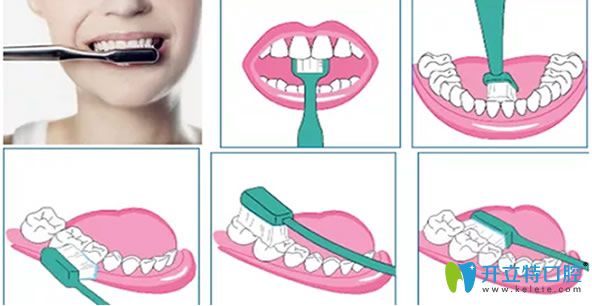 刷牙的正确方法