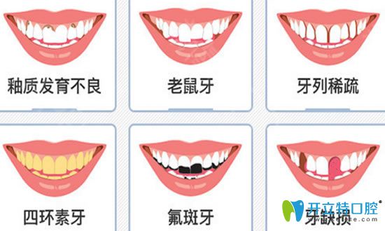 前牙美学修复过程及适应症