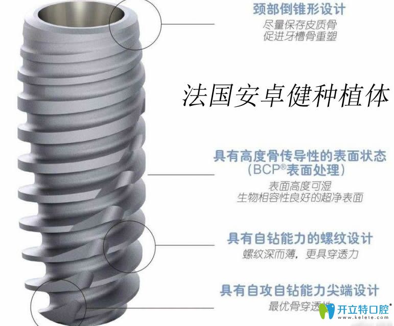 法国安卓健Anthogyr种植体图