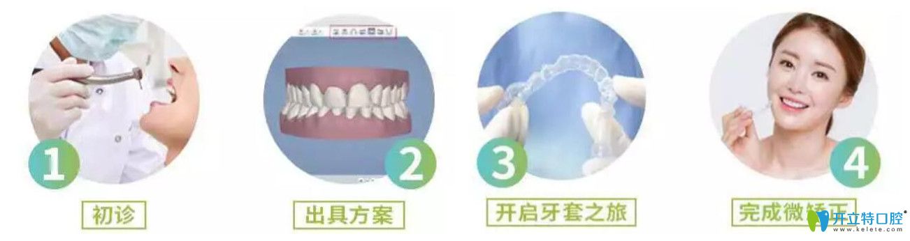 英博口腔隐形微矫怎么样