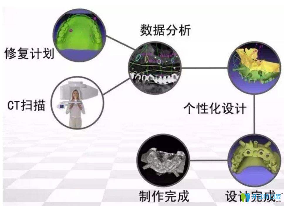 南昌辉煌口腔丁张松医生介绍数字化种植牙技术优势