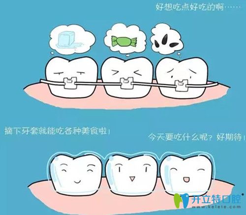 隐形矫正牙套更方便、舒适