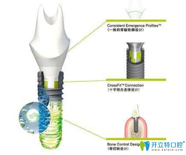 瑞士iti种植体图片