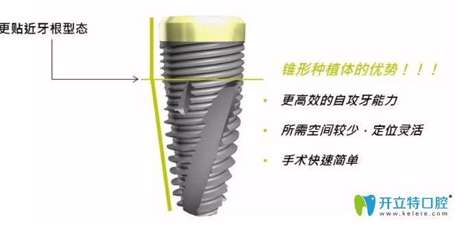 瑞士百丹特种植体的优势