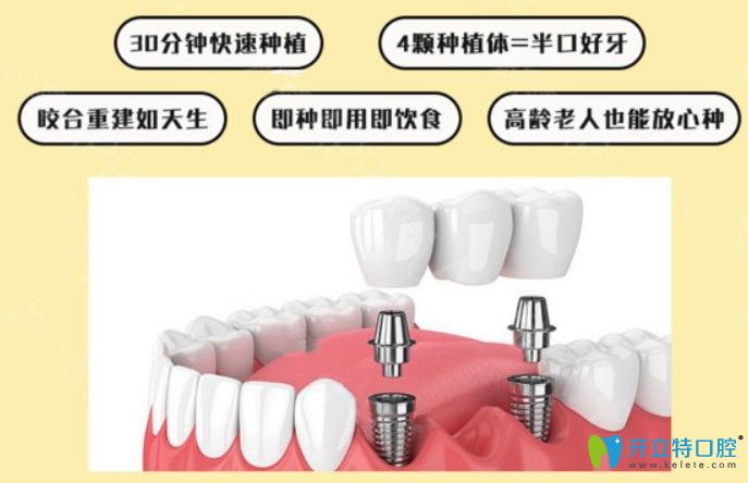 即刻种植牙优缺点