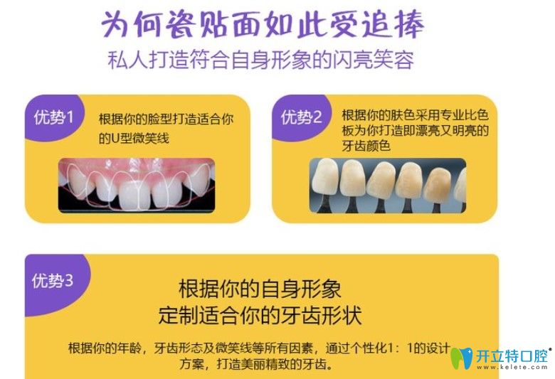 上海伊尔意口腔瓷贴面优势