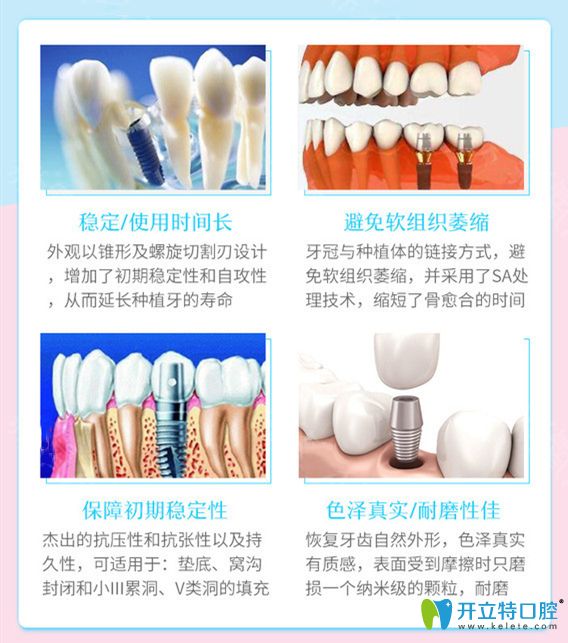 美国皓圣种植体优势