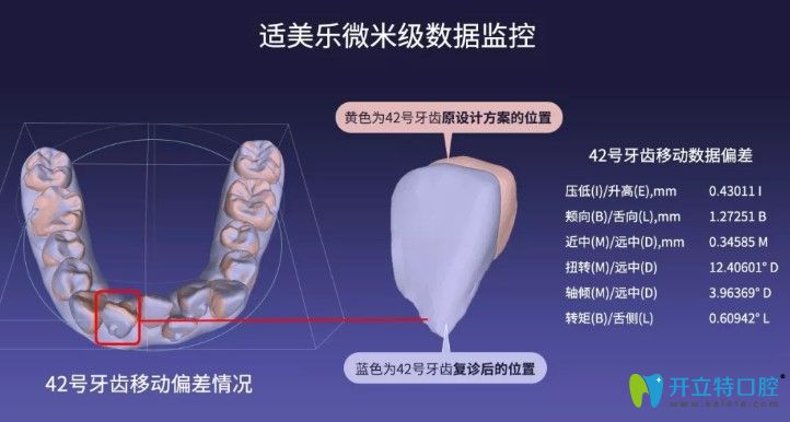 适美乐隐形矫正是国产的