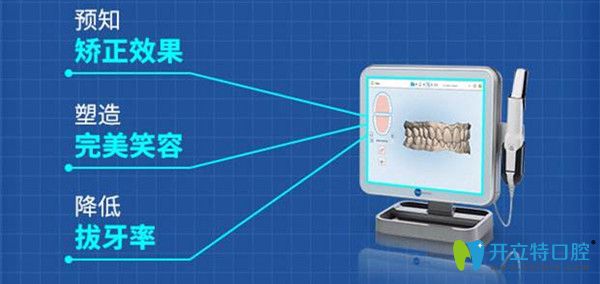 iTero数字化口扫仪