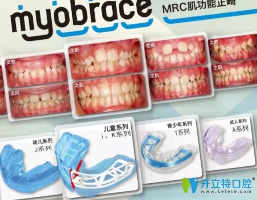 MRC矫正器型号