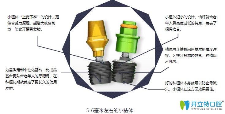 小植体亲骨种植牙的优势有哪些