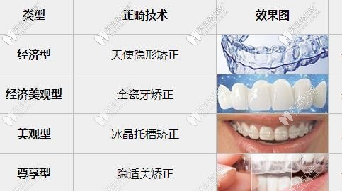 牙齿矫正的不同方式