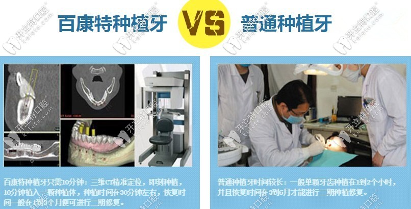 国产种植牙品牌百康特种植体的价格比奥齿泰便宜的多么