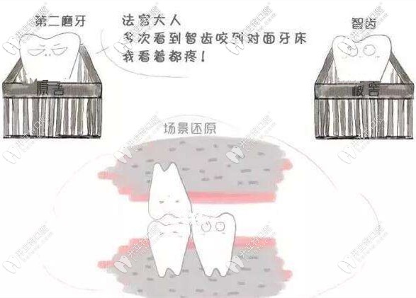 没有咬合关系的智齿需要拔除