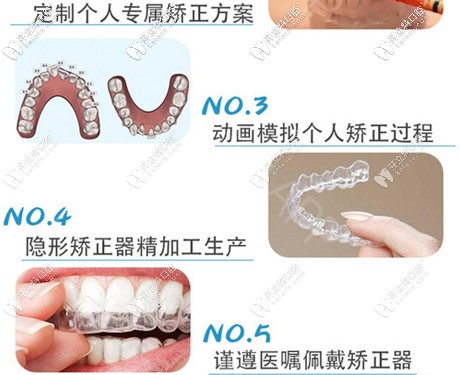 自己在家也能矫正牙齿啦