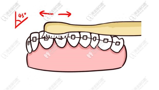 倾斜着刷牙