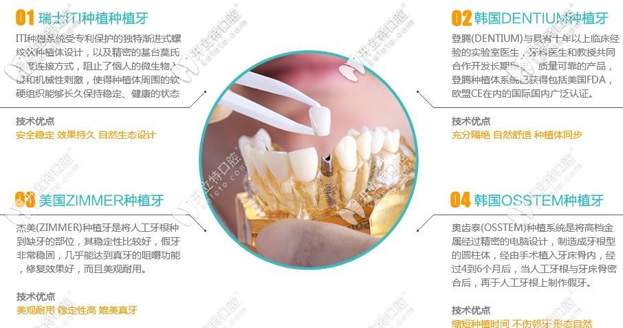 不同品牌种植体优势