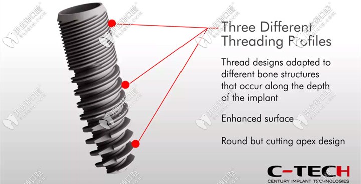 C-TECH西泰克种植体