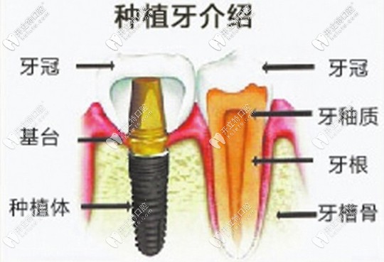 中山香山口腔医院复活节种牙活动