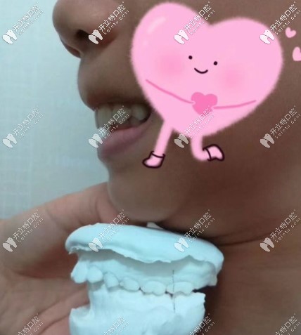 罗慕儿童牙齿矫正图片