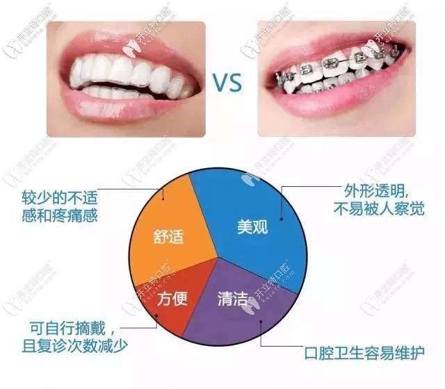 带了钢丝牙套后悔的人快来看这隐形透明牙套多少钱