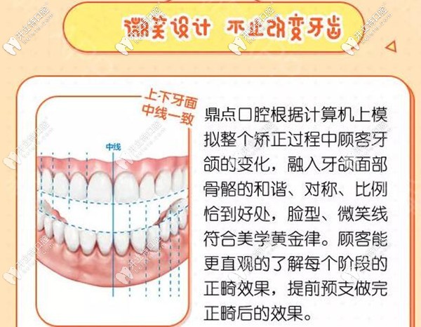 海口鼎点口腔牙齿矫正微笑设计