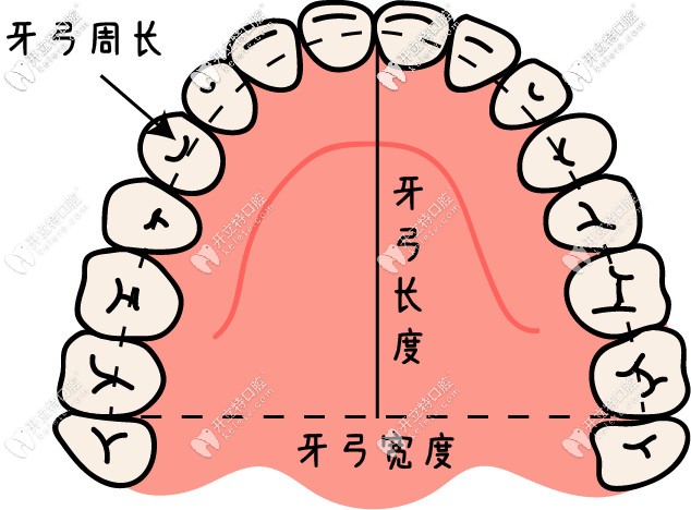 是否需要拔牙要看骨量和牙量是否匹配