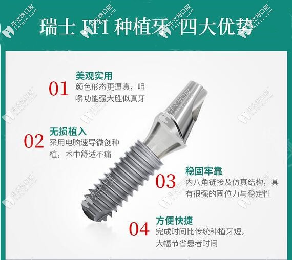 深圳河山口腔门诊部瑞士ITI种植牙优势