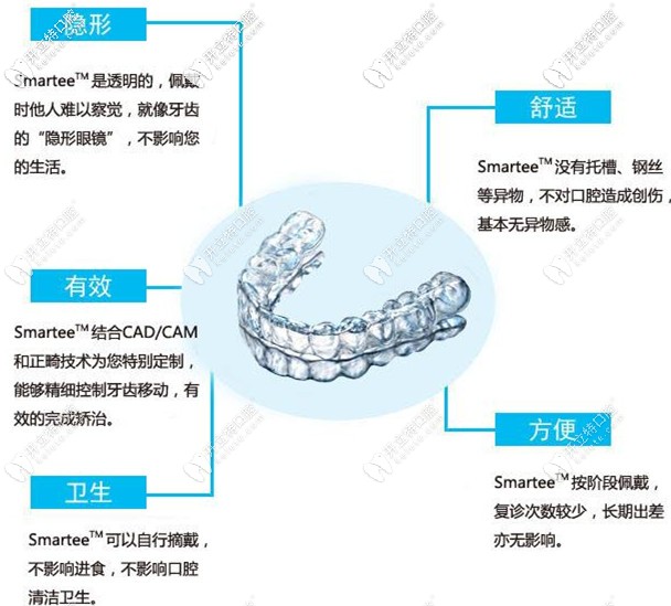 隐形矫正的特点