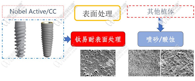 瑞典诺贝尔种植体与其他植体表面处理对比