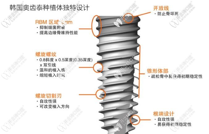 美国hiossen和韩国奥齿泰哪个更好