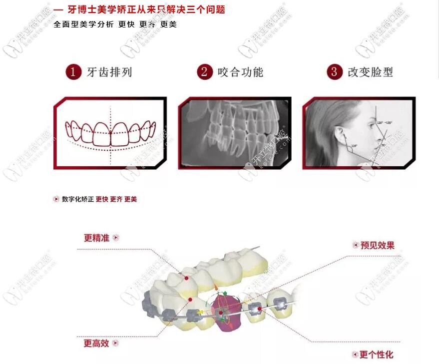 牙博士正畸标准