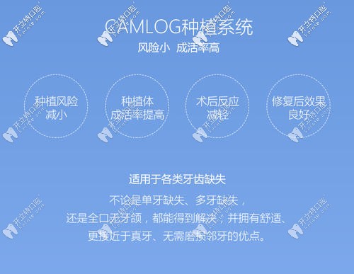 德国Camlog种植牙优势