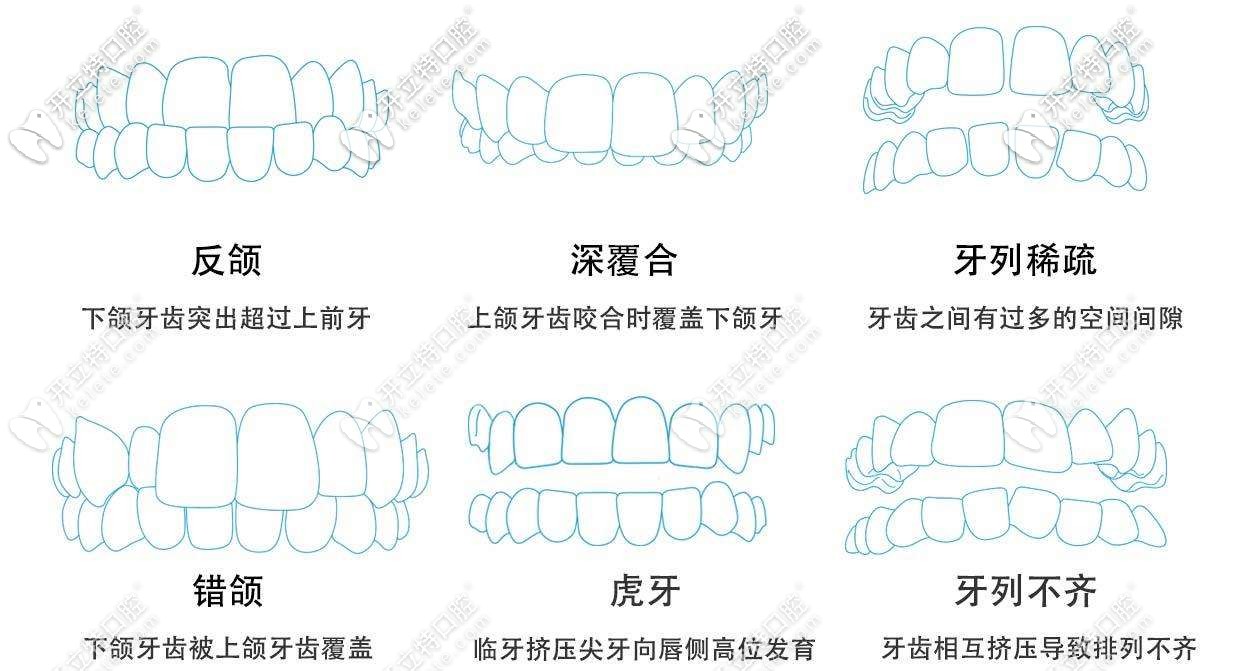 时代天使可适应病例