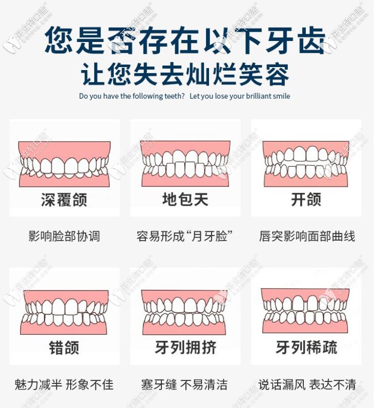 牙齿不齐的类型