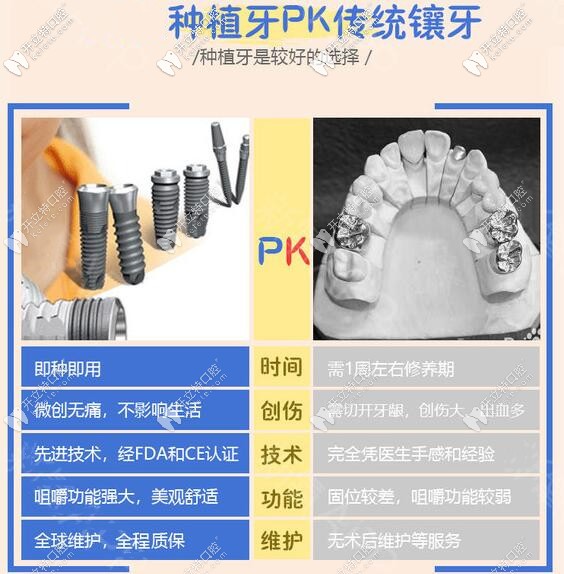 种植牙和传统假牙哪个好