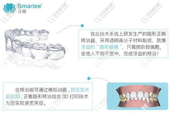 正雅经典版矫正器怎么样