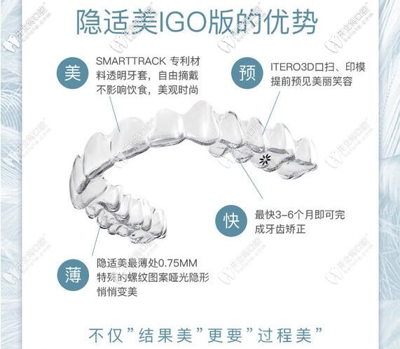 深圳铭德口腔隐适美Igo极速版矫正器