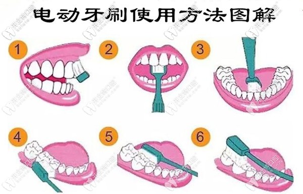 电动牙刷使用方法图解