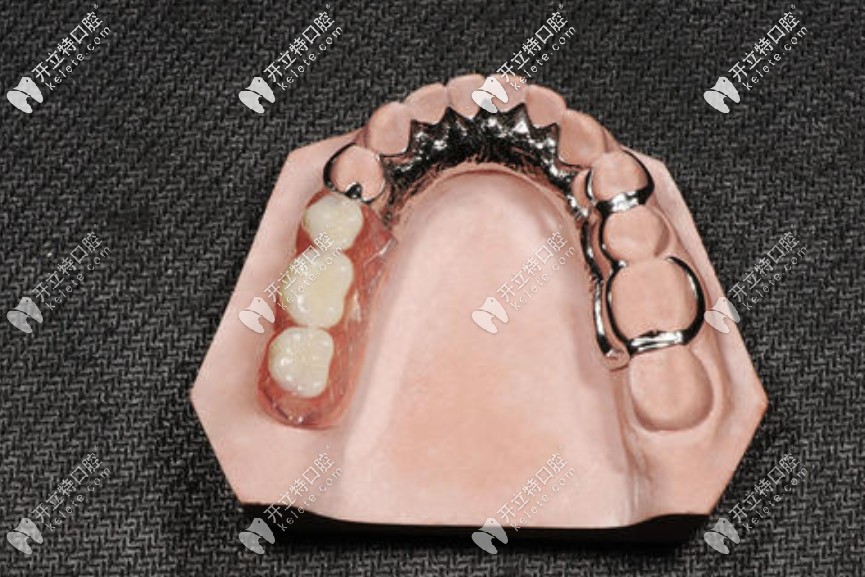 牙齿缺损修复哪种方法比较好?这三种你pick哪一个