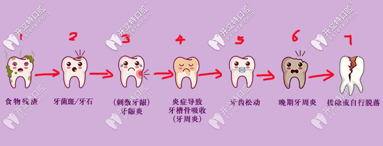 牙齿掉落的过程