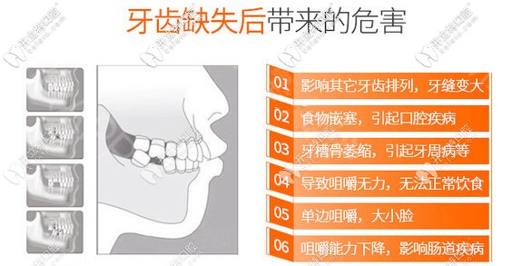 种植牙将被再生牙取代?基因再生牙齿临床仍遥遥无期