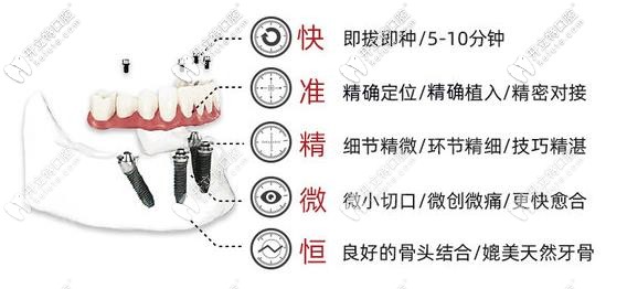 即刻种植、即刻负重技术优势