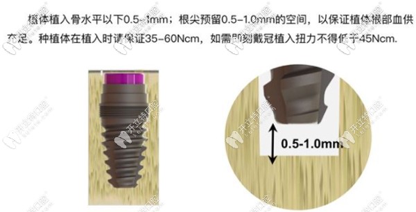 AIDI采用不互通设计防止异味