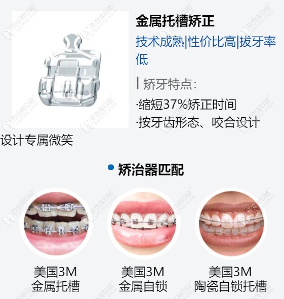 曙光口腔做金属托槽矫正不同的矫治器