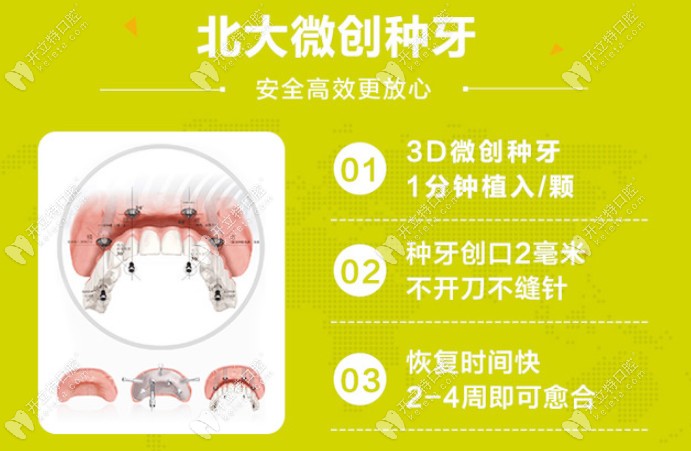 固德口腔种植牙优势